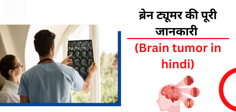 ब्रेन ट्यूमर के मुख्य कारण और लक्षण (Brain tumor in hindi)