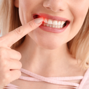 gum problem