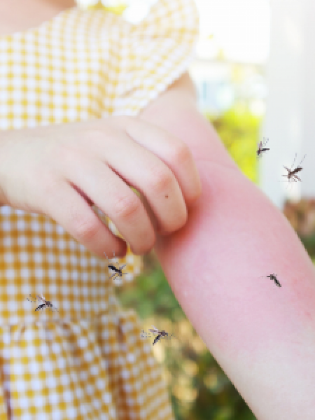 डेंगू से कैसे बचा जाए? [dengue se bachne ke upay]