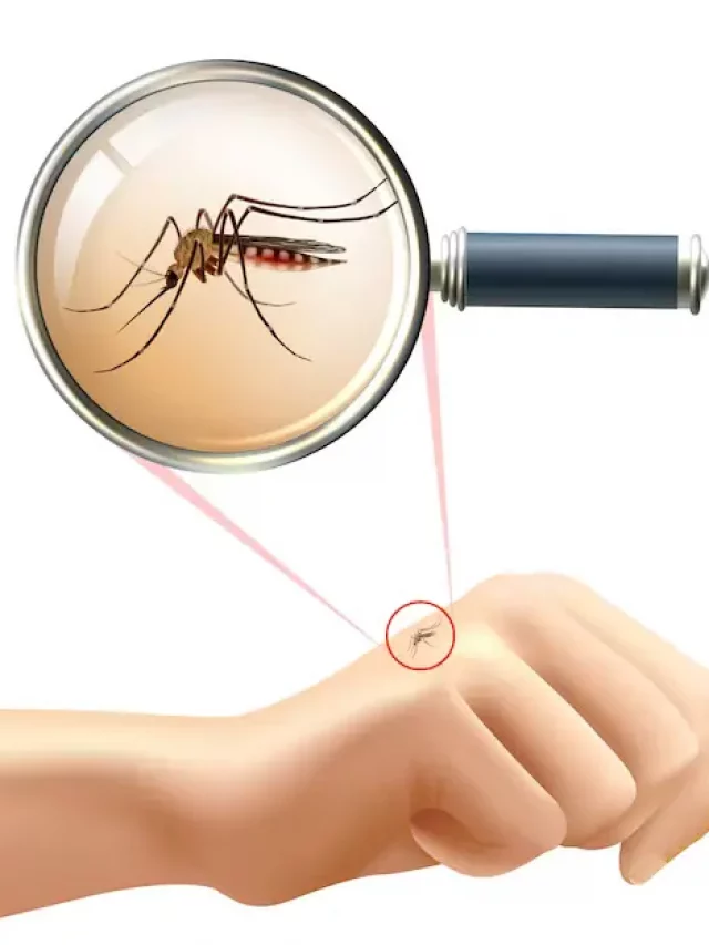डेंगू के कारण क्या हैं? [dengue causes in hindi]