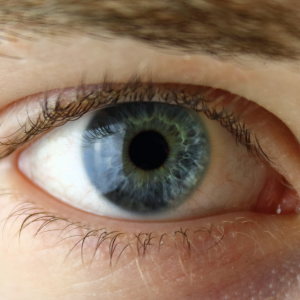reasons for eye floaters