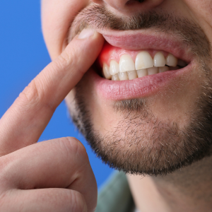gum problems treatment
