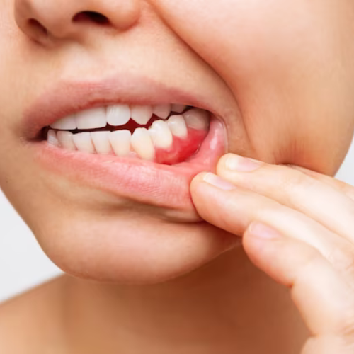 teeth gum problem solution in hindi